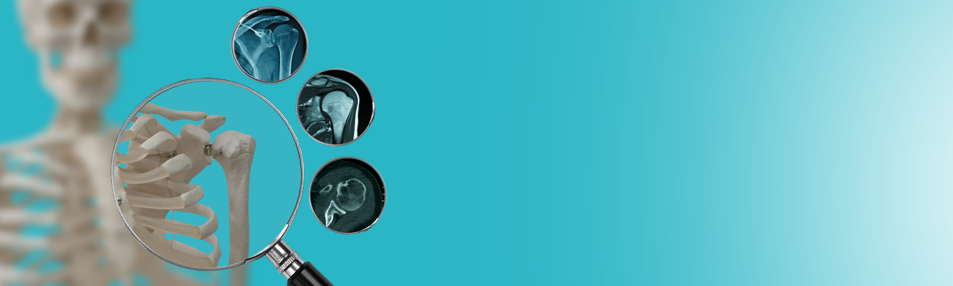 Image Interpretation Series (P4) | CT & MRI