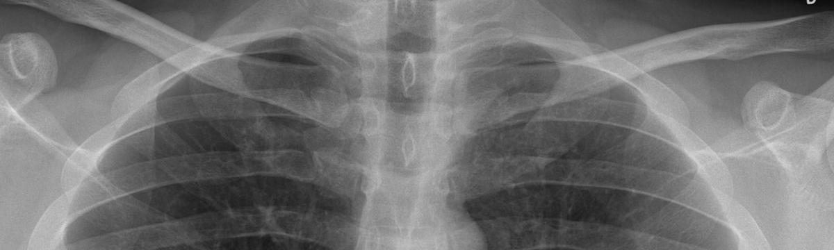 Image Critique Series - Intermediate