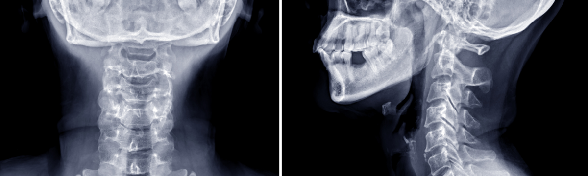 Head and Neck Cancer: From Diagnosis to Treatment